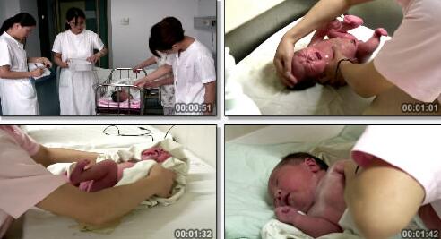 婴儿出生过程实拍片段